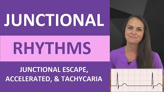 Junctional Rhythms Made Easy EKG Interpretation Nursing NCLEX ECG Review [upl. by Galasyn]