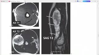 MSK 2 RAD CASE SERIES RADIOLOGY [upl. by Niboc]