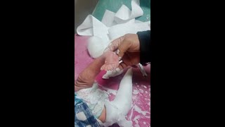 best ponseti technique for clubfoot  Best Ponseti tricks in clubfoot part 2 [upl. by Nonnac]