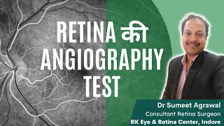 ANGIOGRAPHY TEST  Retina की blood vessels की सबसे important study जानिये सारी details [upl. by Anaiek707]