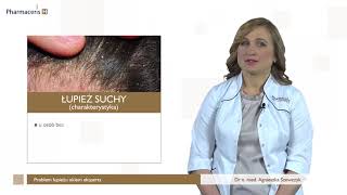 Problem łupieżu – dermatolog dr Agnieszka Szewczyk [upl. by Grekin770]