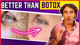 ERASE CROWS FEET IN DAYS WITHOUT BOTOX [upl. by Thacker433]