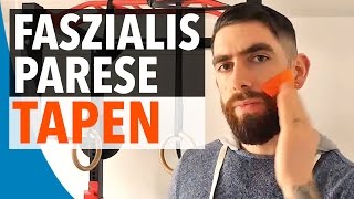 FAZIALISPARESE TAPEN  KinesiologieTape Anleitung für Faszialisparese SchrittfürSchritt [upl. by Natloz183]