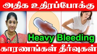 அதிக உதிரப்போக்கு Heavy Bleeding Periods Problem Menorrhagia What we do Reasons Treatments menses [upl. by Lukasz]