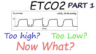 Capnography Waveform Interpretation Etco2 basics explained [upl. by Enelak376]