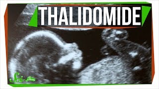 Thalidomide The Chemistry Mistake That Killed Thousands of Babies [upl. by Spiers]