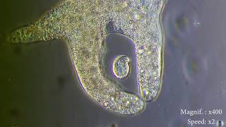 Amoeba eats paramecia  Amoebas lunch   Amoeba Endocytosis  Phagocytosis Part 1  👌 [upl. by Anawed]