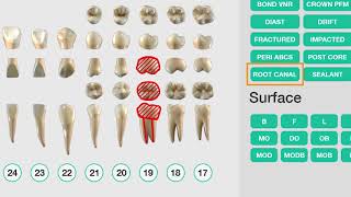 Dental Assisting  Patient Exam [upl. by Akel]