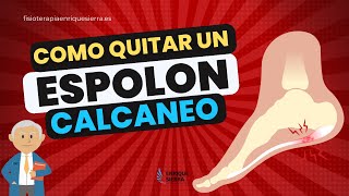 CÓMO QUITAR UN ESPOLÓN CALCÁNEO ✅ ONDAS DE CHOQUE [upl. by Earaj254]