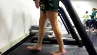 hip circumduction antalgic gait barefoot [upl. by Mellie6]