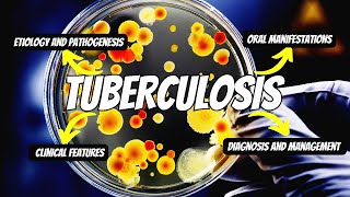 Tuberculosis Explained TB Diagnosis TB Treatment and Oral Manifestations of TB [upl. by Eimoan614]