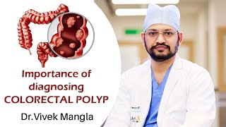 Colorectal polyps What are they and whats their link to colorectal cancer [upl. by Clover]