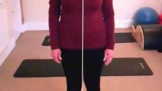 Mums Posture assessment  Kinetic Chain [upl. by Keverian428]