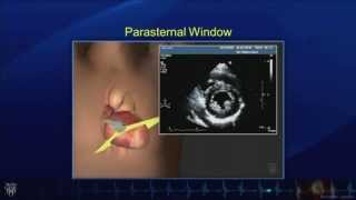 Echo Tutorial Comprehensive Transthoracic Echocardiogram  Mayo Clinic [upl. by Nitaj]