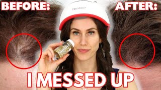 3 Hair loss Mistakes Youre Making Right Now [upl. by Arehahs]