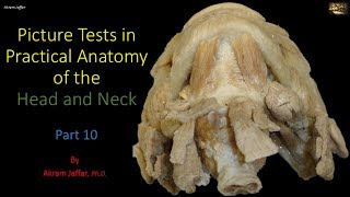 Picture tests in head and neck anatomy 10 [upl. by Valencia851]