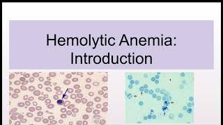 Hemolytic Anemias Introduction and Classification [upl. by Bridget266]