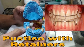 Pustiso with Retainer Upper and Lower Hawley Retainers Dentures with retainers [upl. by Pergrim]