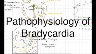 Pathophysiology of Bradycardia [upl. by Lovel]