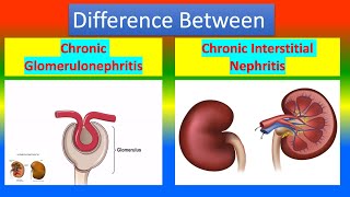 Difference Between Chronic Glomerulonephritis and Chronic Interstitial Nephritis [upl. by Daffodil452]