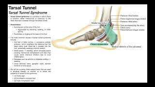 Tarsal Tunnel Syndrome  Clinical Anatomy amp Presentation [upl. by Anivad]