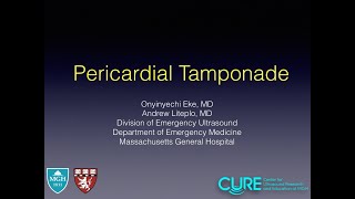 Pericardial Tamponade [upl. by Waal]