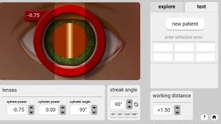 Retinoscopy practice online eye [upl. by Bryce]