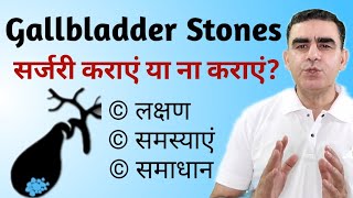 बिना ऑपरेशन के पित्ताशय की पथरी Gallbladder Stone का इलाज  Gallbladder Stones Symptoms [upl. by Eecyac]