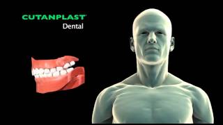 CUTANPLASTdentalENsurgery [upl. by Hainahpez]