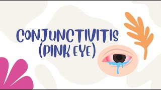 How to treat conjunctivitis pink eye [upl. by Dirgis]