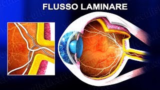 Angiografia a fluorescenza FAG e con verde indocianina ICGA wwwoculisticaTVit [upl. by Artenek]