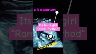 Its baby girl ultrasound  RAMZI THEORY shorts ultrasound genderreveal [upl. by Ronalda867]