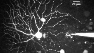 Two photon imaging in the PV retina [upl. by Stephanus]