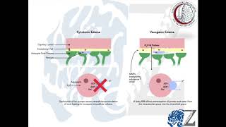 Intracranial Pressure 3 Management ضغط المخ [upl. by Pass]