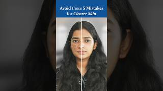 5 Dark Spot Mistakes RUINING Your Skin [upl. by O'Driscoll487]