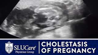 Cholestasis of Pregnancy Treating Itchy Hands amp Preventing Still Birth  SLUCare OBGYN [upl. by Hosea]