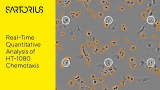 Chemotaxis Cell Migration and Invasion Assay [upl. by Haisi939]