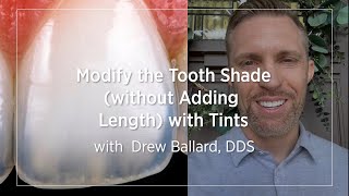 Modify the Tooth Shade without Adding Length with Tints [upl. by Ysnap]