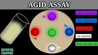 Agar Gel Immunodiffusion Assay  AGID Assay [upl. by Enavi]