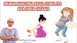 DHABAR XANUUNKA XILGA UURKA IYO SIDA LOOLA TACAALO Dr faris [upl. by Aicssej]