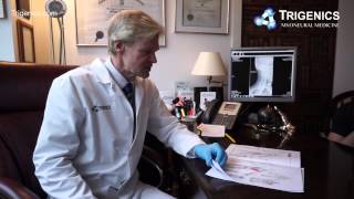 TRIGENICS CASES FOCAL DYSTONIA TREATMENT DR ALLAN OOLO [upl. by Kenneth]