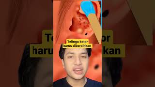 TELINGA KOTOR HARUS DIBERSIHKAN viral shortsviral [upl. by Anolla]