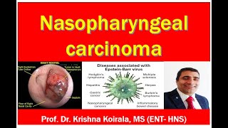 Nasopharyngeal Carcinoma  Medical students  Slide Explanation Dr Krishnas ENT Lectures [upl. by Fergus307]