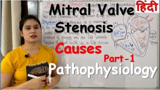 Mitral Valve Stenosis in Hindi  Definition  Causes Pathophysiology  Part1 [upl. by Adur]