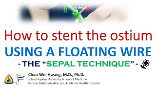 Floating Wire Stenting of AortoOstial Lesions quotSepal Techniquequot [upl. by Sanbo]