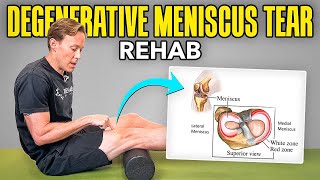 4 Rehab Exercises for a Degenerative Meniscus Tear [upl. by Angrist]