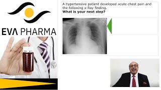 cme internalmedicine Medicine usmle Hypertension  Acute Chest Pain Answer محاضراتباطنة [upl. by Meda858]