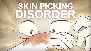 Skin Picking Disorder  What is it [upl. by Aleciram]