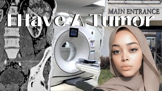 Finding Out I Have A Tumor In My 20s  LipomaSarcoma Ultrasound  CT Scan Reports [upl. by Silvan]