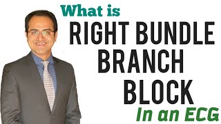 Right Bundle Branch Block RBBB ECG Interpretation Explained How to identify RBBB BlockUSMLE NEET [upl. by Ainahpets780]